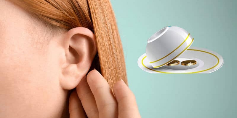 Định nghĩa cách nghe vị Xóc Đĩa